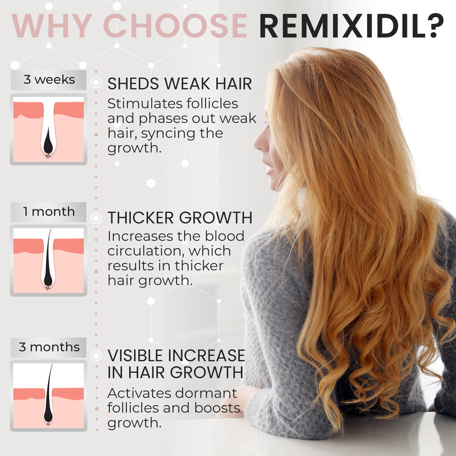 Remixidil Women's 2% Minoxidil Scalp Spray